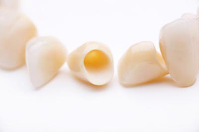Dental Crowns | Booragoon Dentist