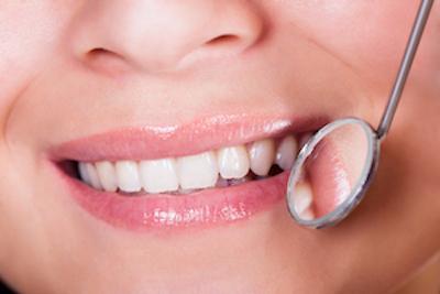 Smile | Dental Fillings Garden City