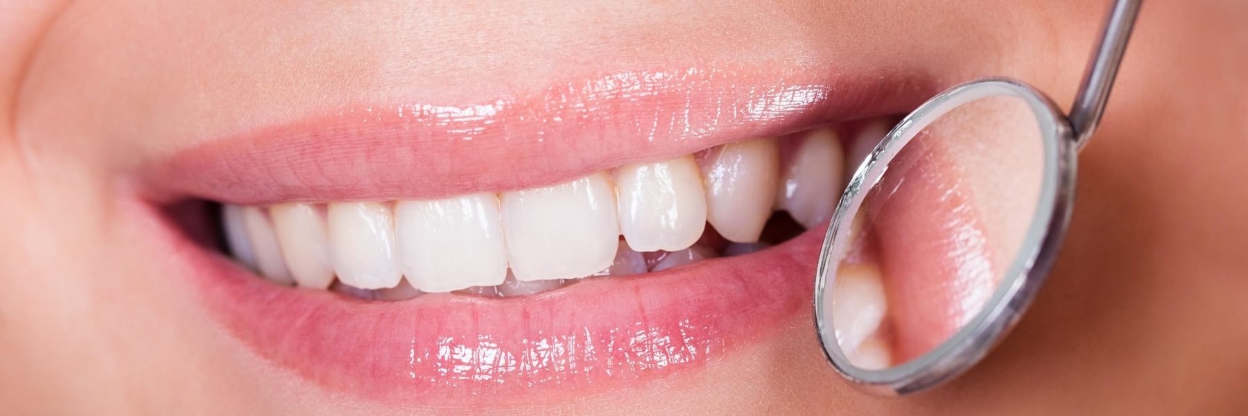 Smile | Dental Extractions in Booragoon 