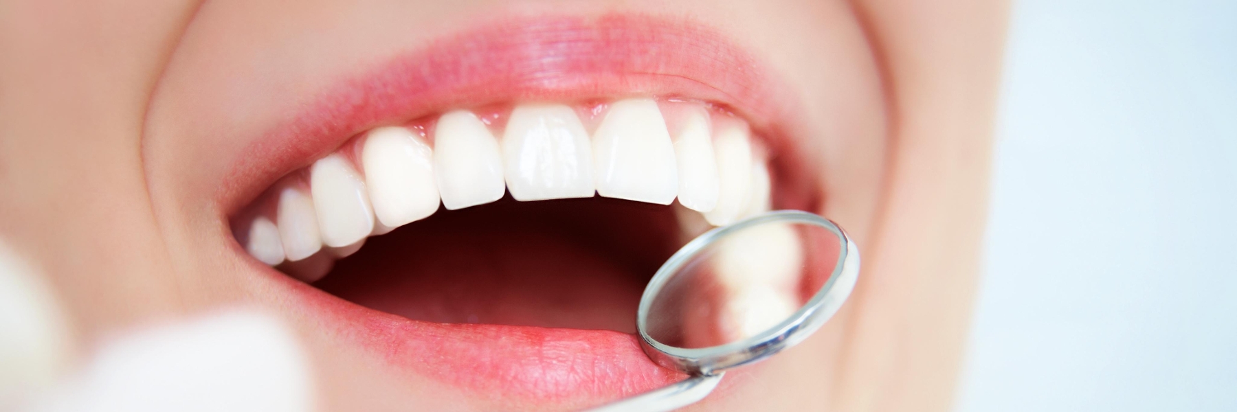 Teeth | Dental Crowns in Booragoon