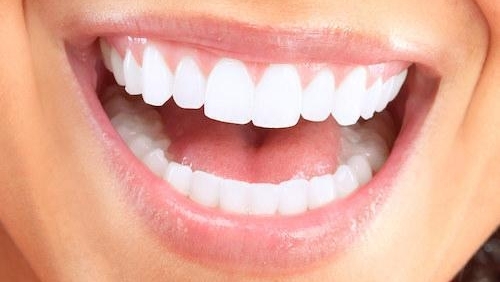 Woman with cosmetic dentistry in Booragoon WA